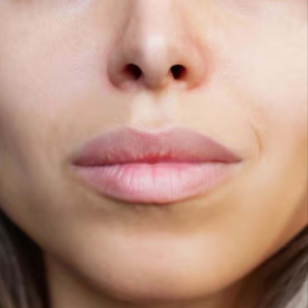 Close-up van lippen na lipfiller
